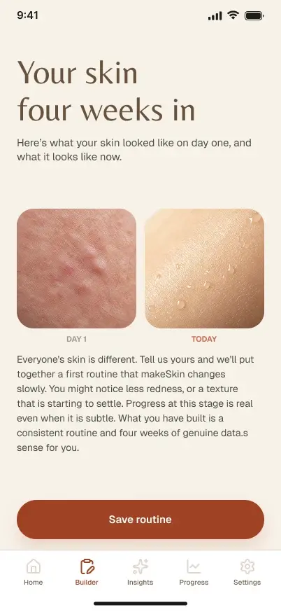 SkinSync four weeks in screen